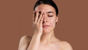 INDIESPOT Ini 5 Cara Menghilangkan Lemak di Dagu, Bye-bye Double Chin!
