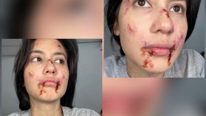 INDIESPOT.ID Potret Wajah Pevita Pearce yang ‘Babak Belur’, Warganet: Cantik Bener
